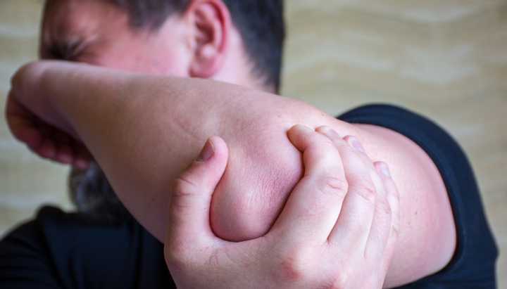 Syndrome de compression du nerf cubital (ou nerf ulnaire) à l'origine de douleurs, de paresthésies et d'une perte de force dans la main.