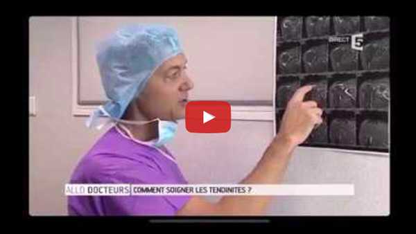 Reportage sur le traitement chirurgical des tendinites de l'épaule, diffusé dans Allô Docteurs sur France 5.